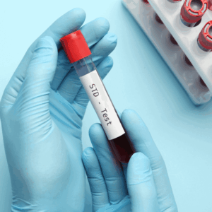 STD 10 Panel (Real Time PCR)